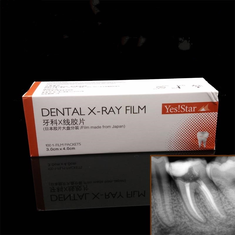 Dental X Ray Film