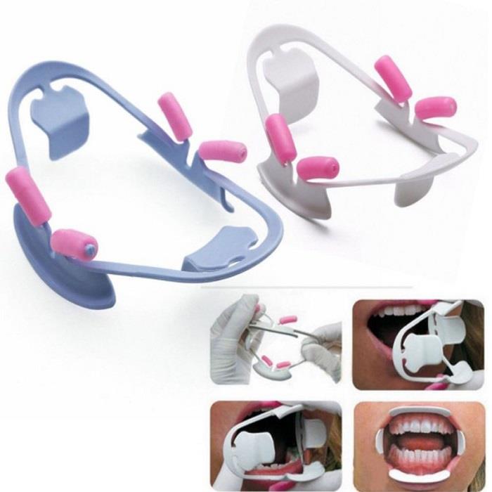 3D Mouth Opener