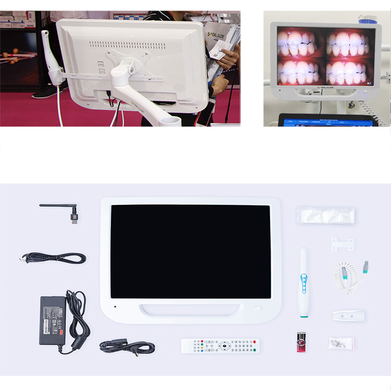 The intra oral camera with 17 inch screen